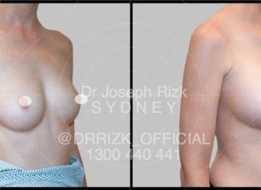 Dr Joseph Rizk – Plastic & Reconstructive Surgeon