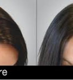 Sani PRP Hair MD