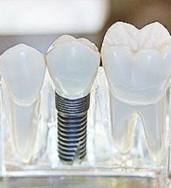 Arrowhead Smiles and Anesthesia
