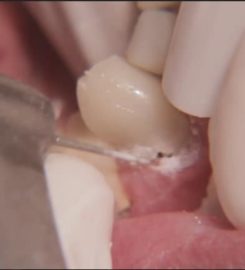 Cherrydale Family Dental