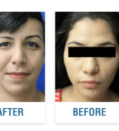 Mardirossian Facial Aesthetics