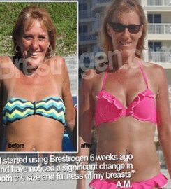 Breast Firming Treatment Ltd