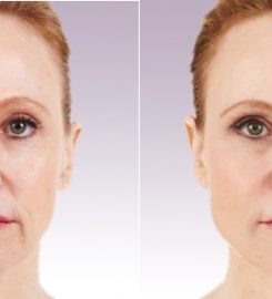 Cosmetic Surgery Of Indianapolis