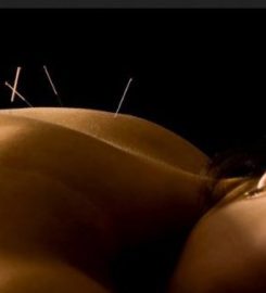 Sheila Acupuncture Naples
