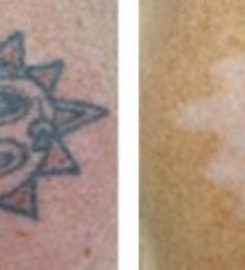 Cosmetic Surgery Of Indianapolis