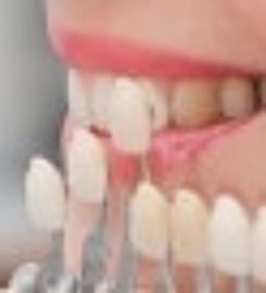 Dr. Gary Cash, DDS