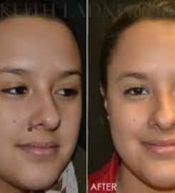 Ladner Facial Plastic Surgery