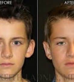 Ladner Facial Plastic Surgery