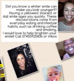 Superstar-Smiles