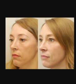 Skin Excellence Clinics