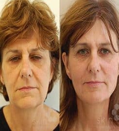 Skin Excellence Clinics