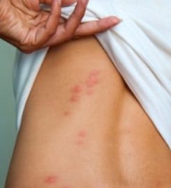Phoenix Bed Bug Expert