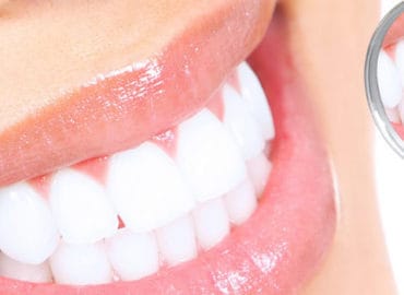 Teeth Whitening Bournemouth