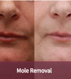 Skin Excellence Clinics