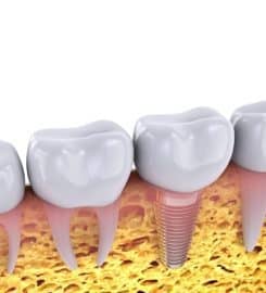 Riverpoint Family, Cosmetic & Implant Dentistry