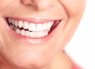 Aesthetic Dentistry of Arrowhead