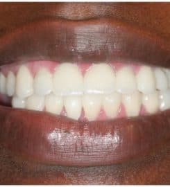 Stanton Smiles Fort Lauderdale FL