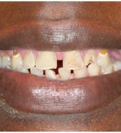 Stanton Smiles Fort Lauderdale FL