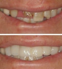 Stanton Smiles Fort Lauderdale FL