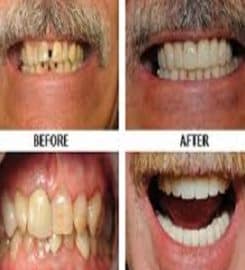 Cosmetic Dentist Scottsdale Experts