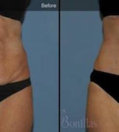 Dr. Robert Bonillas, Plastic Surgery