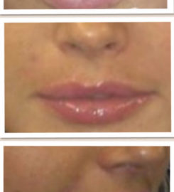 The Smi Permanent Makeup Clinic