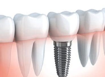 Select Dental Care