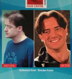 Hair Centre International