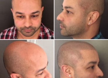 Scalp Authority