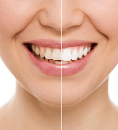 Putnam Bright Smile