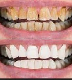 Dr. Joseph Rajabi, DDS – Cosmetic Dentist