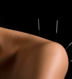 Giordano Acupuncture