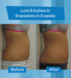 Dr. Tred’s Slim Body Laser Spa