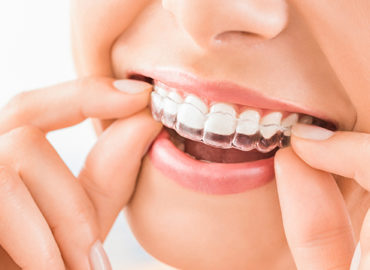 Scottsdales Dentist