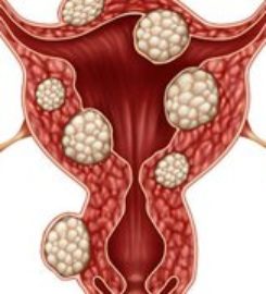 Best Gynecologist NYC – Manhattan Specialty Care