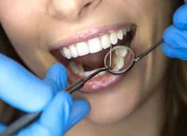 Denture Implants