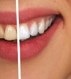 Northbrook Dentist Office