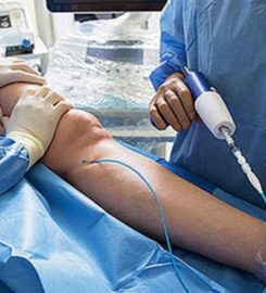 Varicose Vein Treatments Center