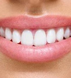 Dental at Joondalup