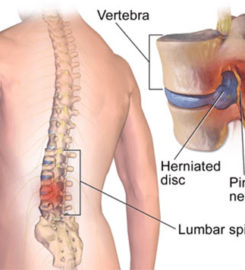 Chiropractic Adjustment