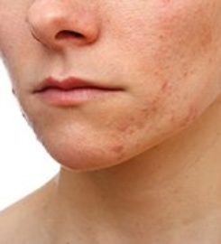 Dermatologist NYC – Susan Bard, M.D.