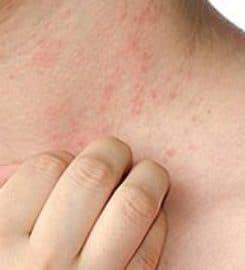 Dermatologist NYC – Susan Bard, M.D.