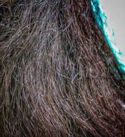 Follicle Hair Clinic