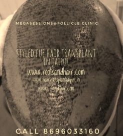 Follicle Hair Clinic