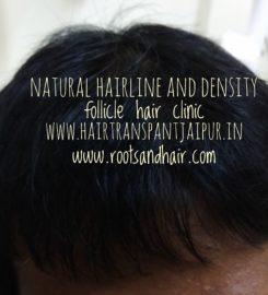 Follicle Hair Clinic
