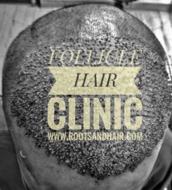 Follicle Hair Clinic