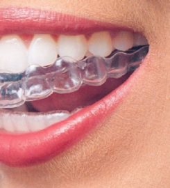 Invisalign Brooklyn