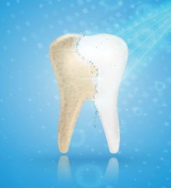 Zirconia Crowns Brooklyn