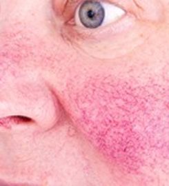 Laser & Mohs Dermatology of NYC
