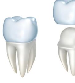 The Tooth Spa